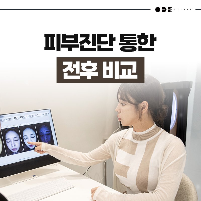 subtle facial rejuvenation Seoul